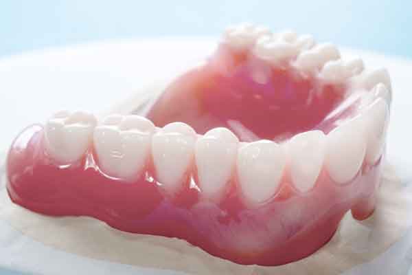 close-up-complete-denture-full-denture-blue-background-denture-600x400 - stafford st marys dental clinic