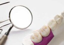 closeup-implant-prosthodontics-prosthetic-tooth-crown-bridge-implant-dentistry-equipment-model-express-fix-restoration